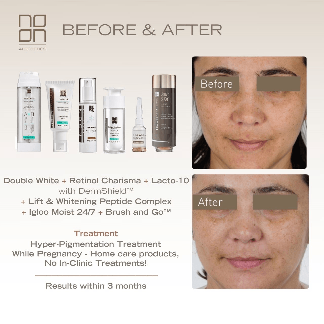 Noon Before & After